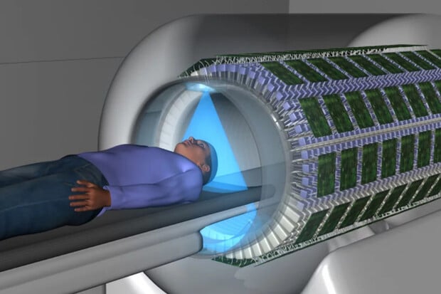 Průlomový skener EXPLORER získá kompletní sken lidského těla za pouhou půlminutu
