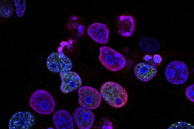 Koktejl chemoterapie a imunoterapie může pomoci v boji s rakovinou