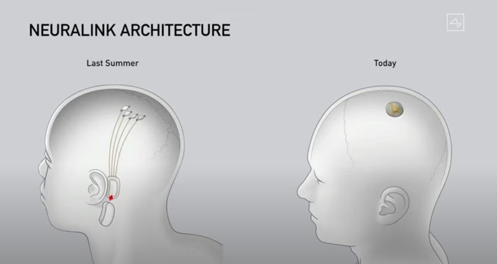 Neuralink