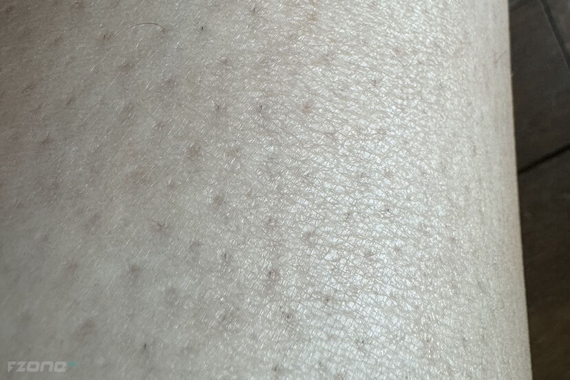 Philips Lumea IPL 9900 Series