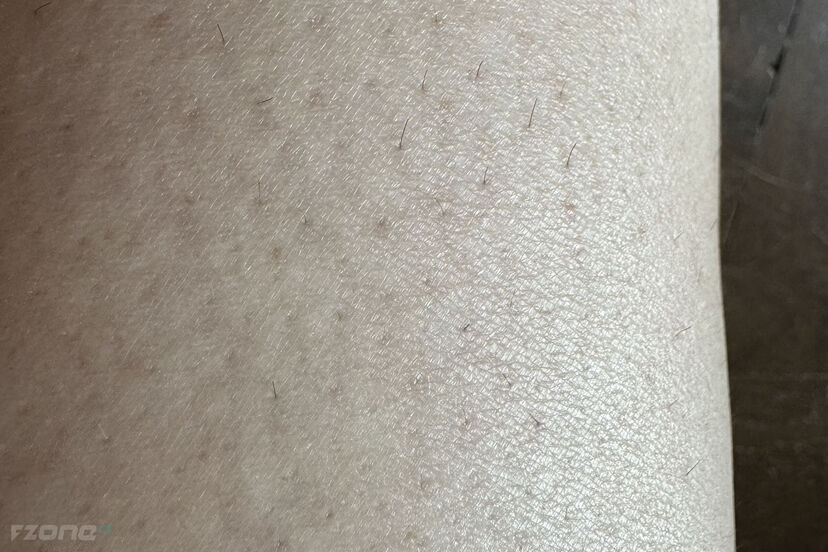 Philips Lumea IPL 9900 Series