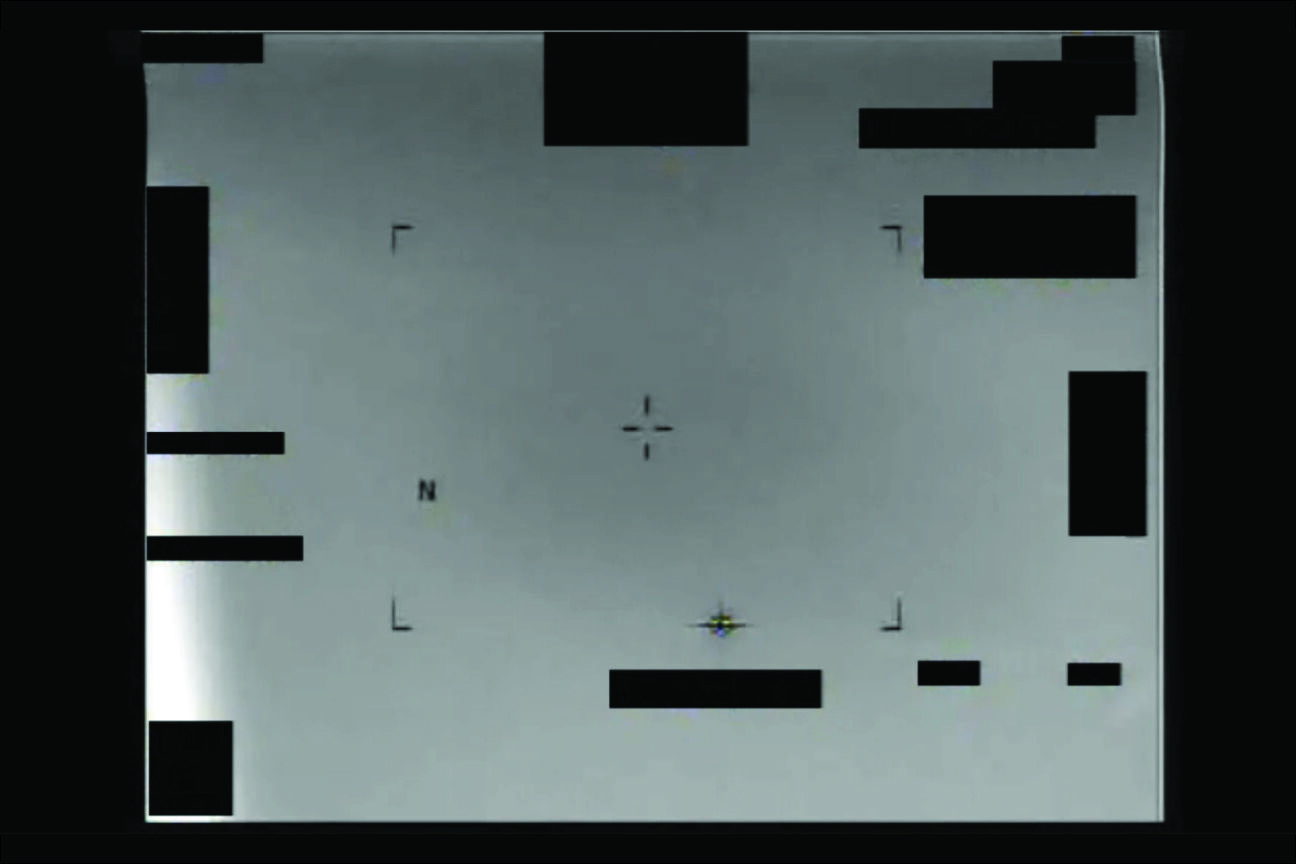 UAP
